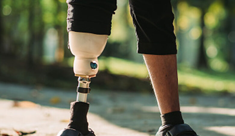Prosthetics