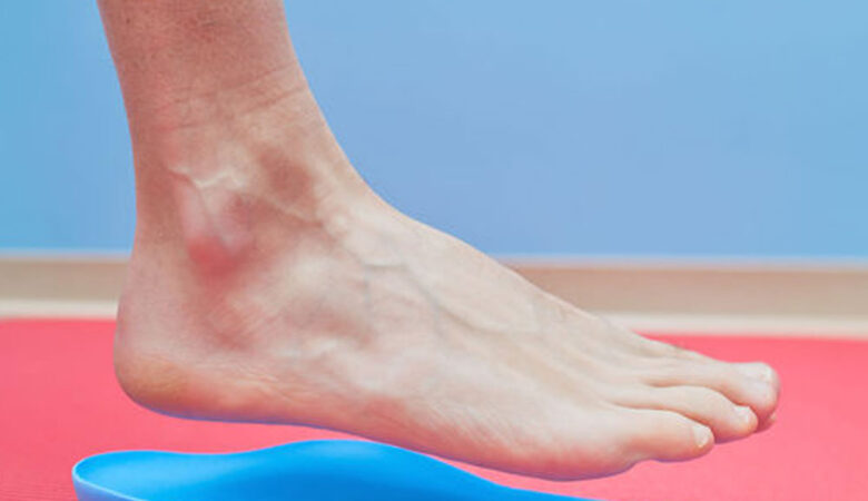 Orthotics